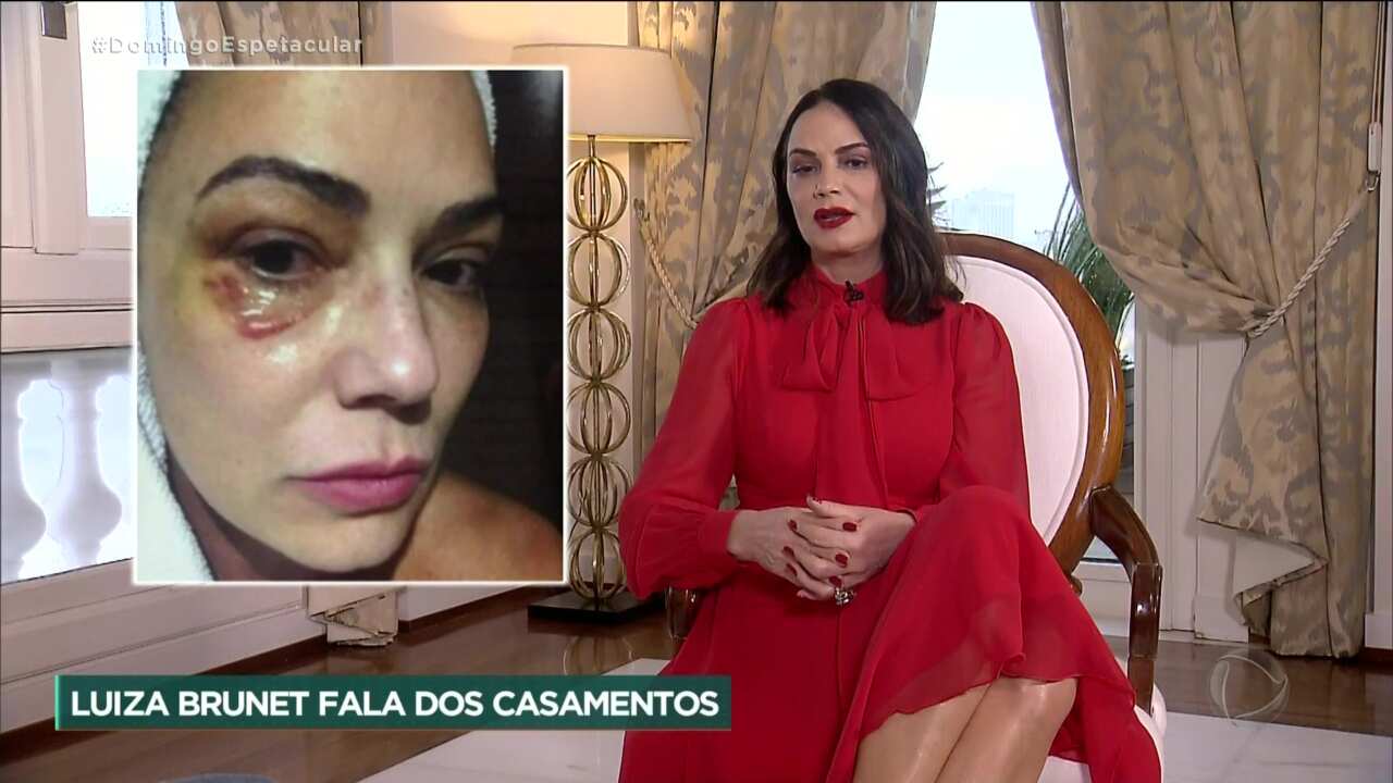 Luiza Brunet fala sobre agressão que viveu em 2016