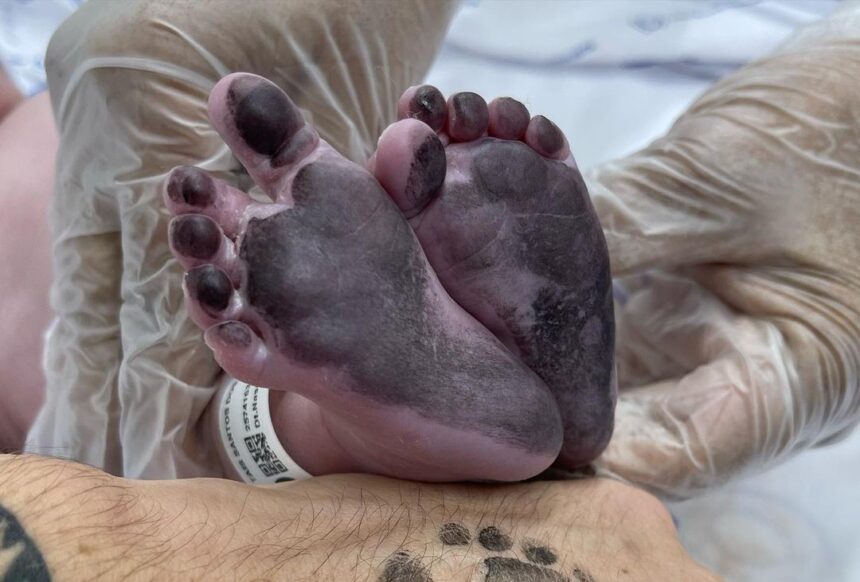 Pezinhos de Pietra, com as mãos de Biel e do Médico