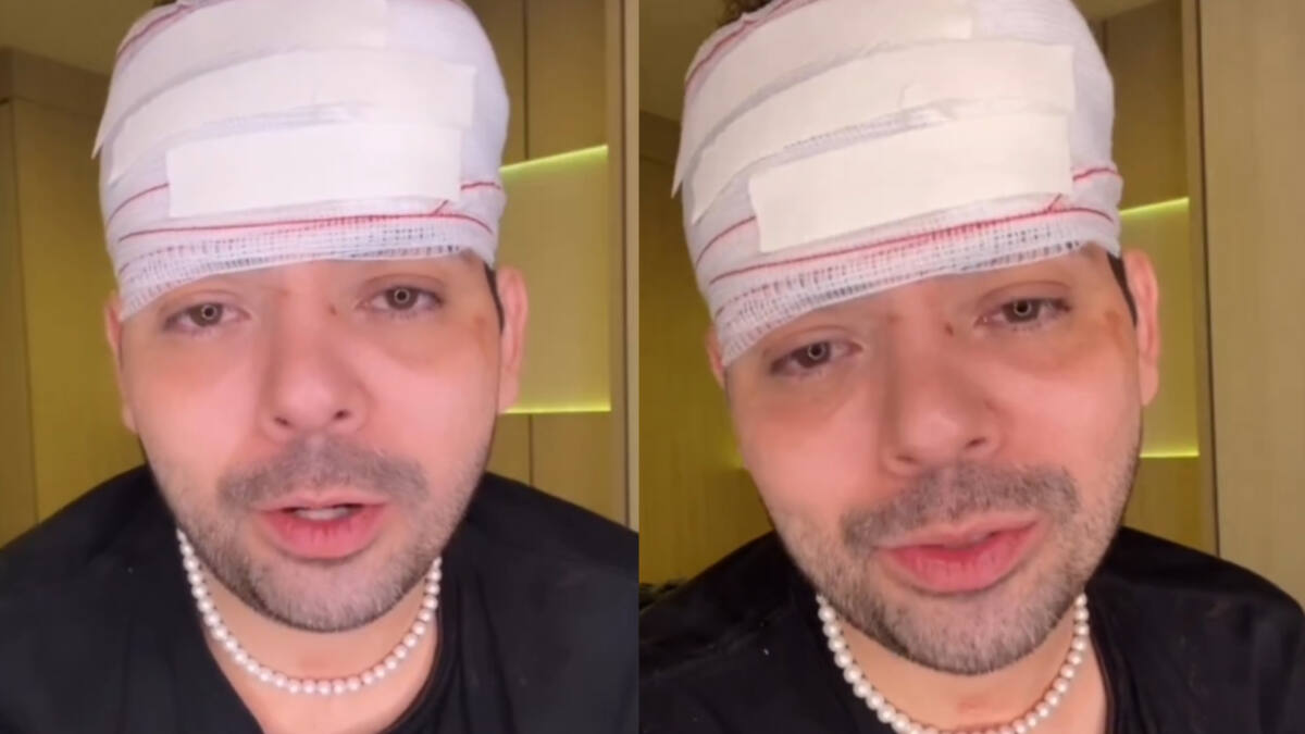 Gustavo Mendes em trechos do vídeo publicado no Instagram em que aparece com a cabeça enfaixada