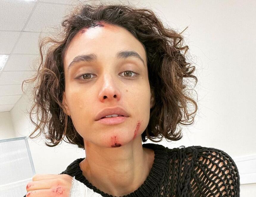 Débora Nascimento apareceu com ferimentos falsos em publicação no Instagram