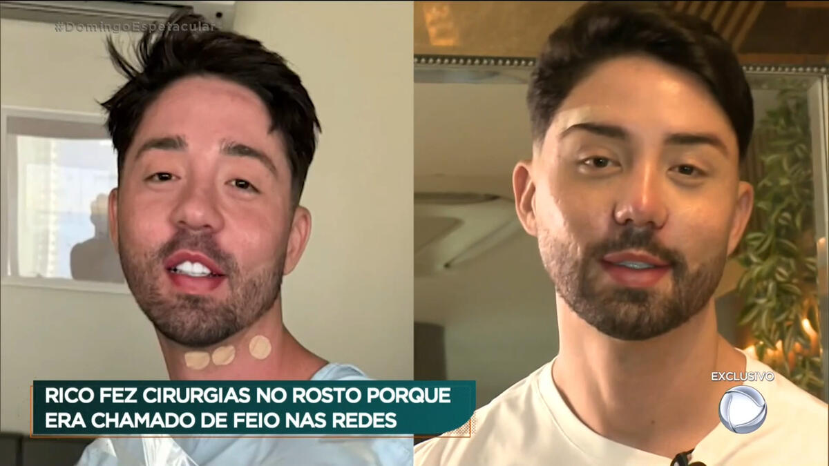 Antes e depois do visual do Rico Melquiades, em trecho da entrevista ao Domingo Espetacular