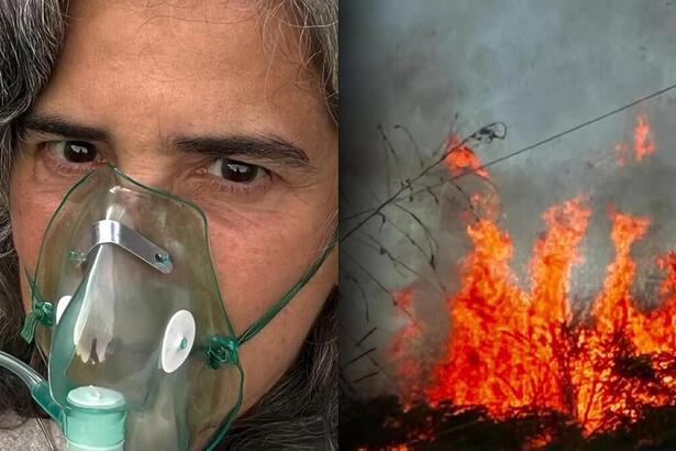 Lúcia Veríssimo com máscara de oxigênio após incêndio em sua Fazenda em Minas Gerais