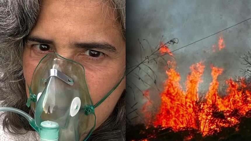 Lúcia Veríssimo com máscara de oxigênio após incêndio em sua Fazenda em Minas Gerais