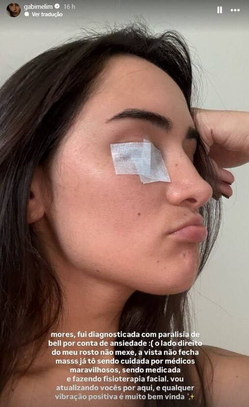 Gabi Melim, em trecho de publicação nos stories do Instagram, com um curativo no olho