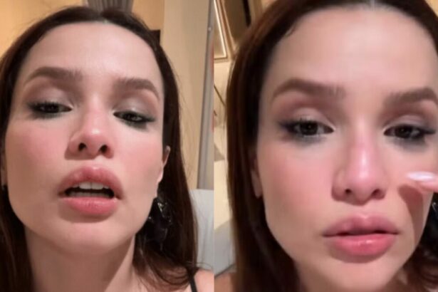 Juliette mostrando uma fratura no nariz que sofreu após acidente doméstico
