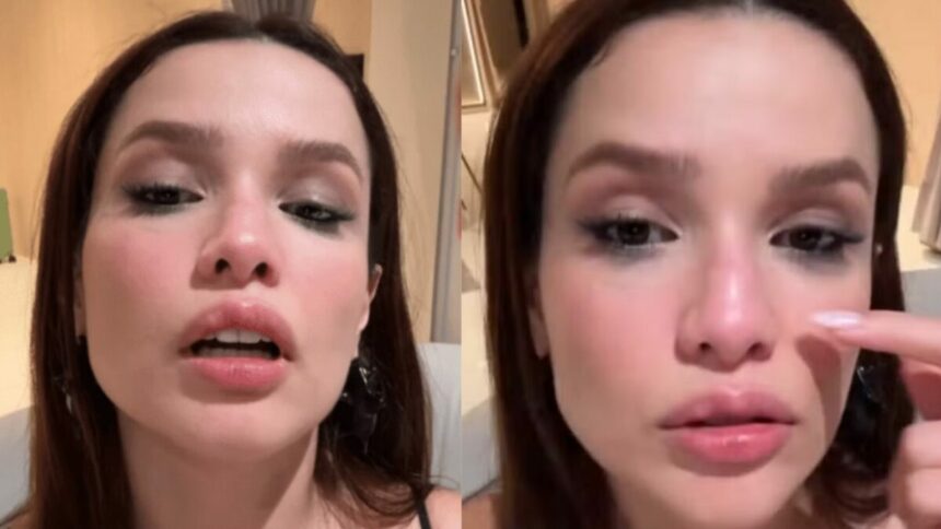 Juliette mostrando uma fratura no nariz que sofreu após acidente doméstico