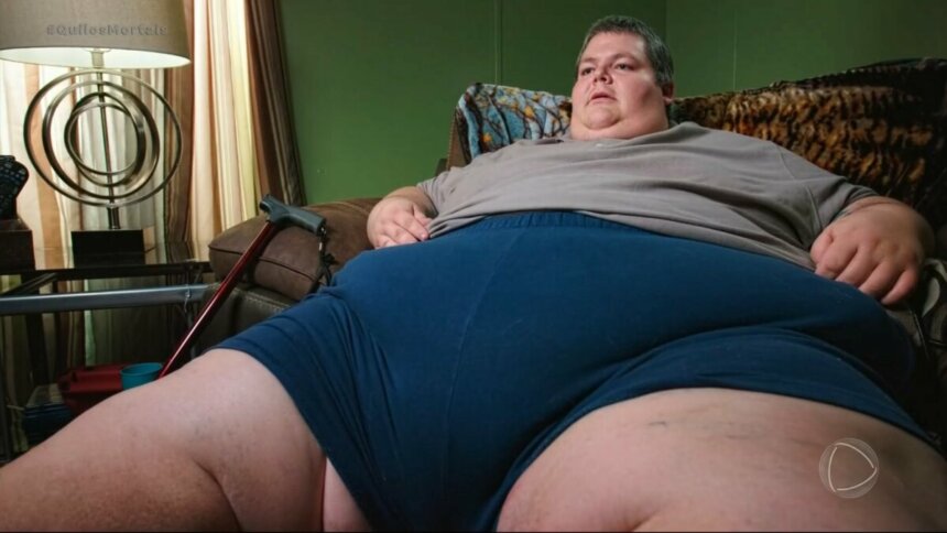 Aaron extremamente obeso, pesando 326 quilos, sentado em um sofá. Suas pernas e barriga se confundem