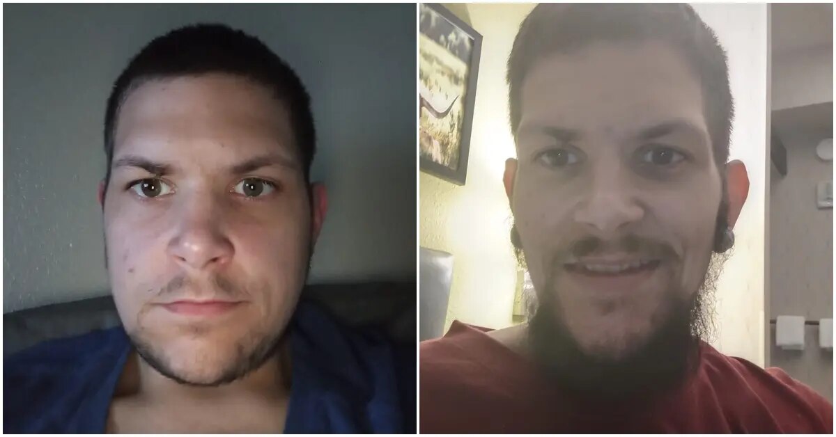 Montagem de duas fotos do rosto de J.T., mostrando a transformação do antes e depois do seu processo de emagrecimento.