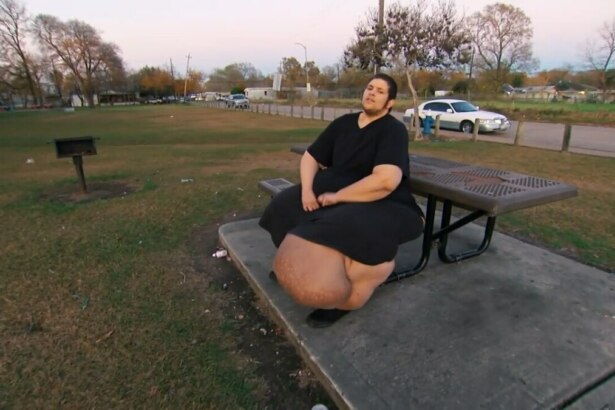 Paciente J.T. do programa "Quilos Mortais", sentado na lateral de um banco de cimento acoplado a uma mesa de piquenique. Ele usa uma camiseta e calças pretas. Sua perna esquerda exibe um grande inchaço causado por linfedema. Ao fundo, há um parque com árvores, grama e uma estrada