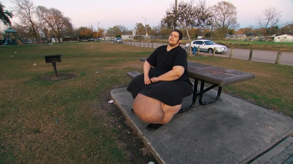 Paciente J.T. do programa "Quilos Mortais", sentado na lateral de um banco de cimento acoplado a uma mesa de piquenique. Ele usa uma camiseta e calças pretas. Sua perna esquerda exibe um grande inchaço causado por linfedema. Ao fundo, há um parque com árvores, grama e uma estrada